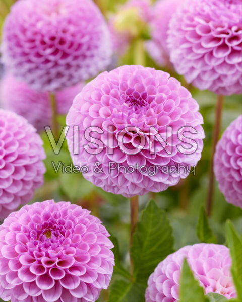 Dahlia Lipoma